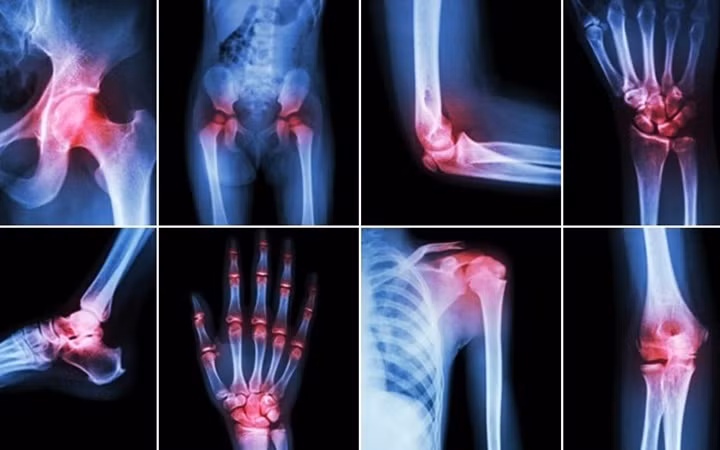 10 căn bệnh của mùa Đông mà ai cũng có thể mắc phải