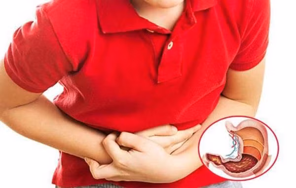 Viêm loét dạ dày là một trong những bệnh lý đường tiêu hóa ngày càng phổ biến.