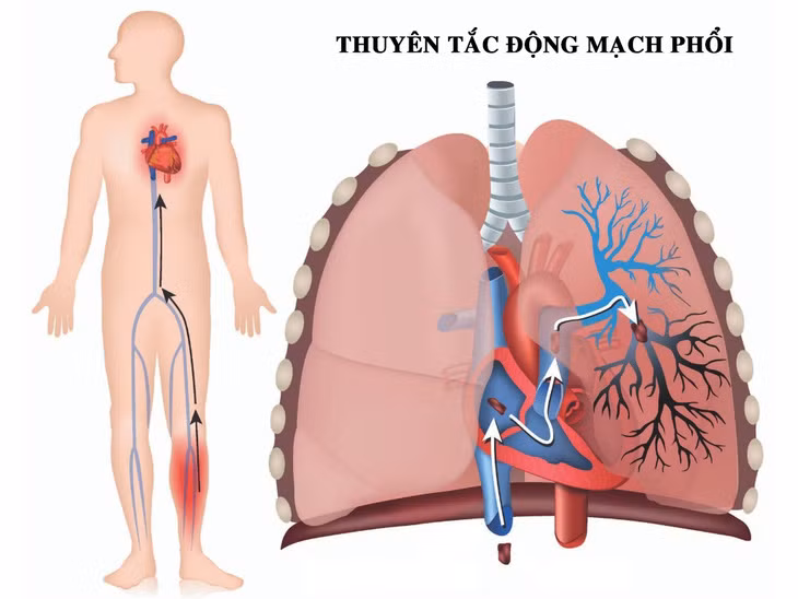 Ảnh minh họa - BVCC