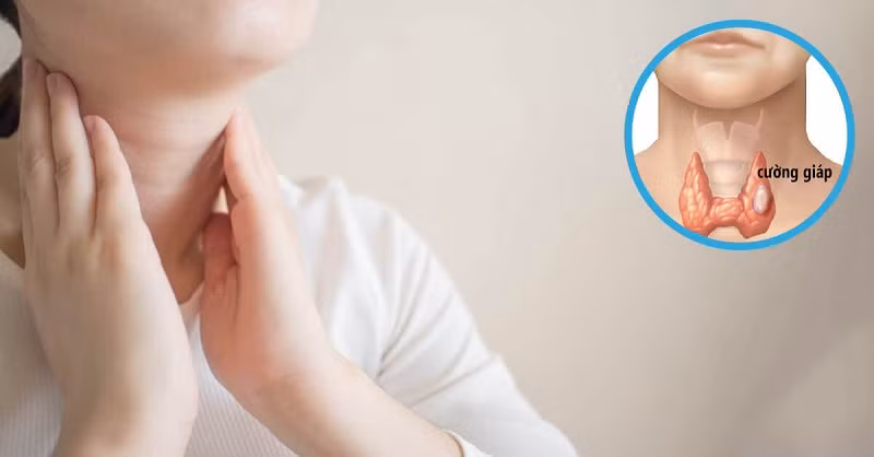 Các bệnh về tuyến giáp rất thường gặp và hay bị bỏ sót không được chẩn đoán.