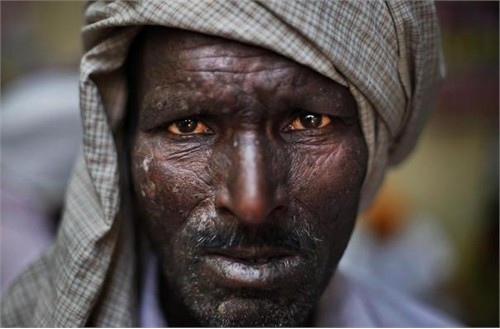 Một chân dung ở New Delhi, Ấn Độ. Ánh mắt của người đàn ông khi đang chứng kiến những người Sikh biểu tình, chống lại quyết định tha bổng ông Sajjan Kumar. Ông này bị xử về tội xúi dục đám đông gây bạo loạn chống lại người Sikh vào năm 1984.