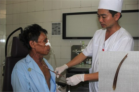 Bệnh nhân Bài suýt mất mạng vì chủ quan sau khi bị hóc xương gà