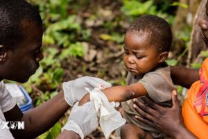 Số ca mắc bệnh đậu mùa khỉ tăng theo cấp số nhân tại Cộng hòa Dân chủ Congo