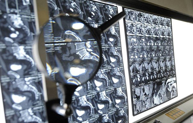 Nga phát triển thuốc điều trị ung thư mới có thể đạt hiệu quả hơn 90%