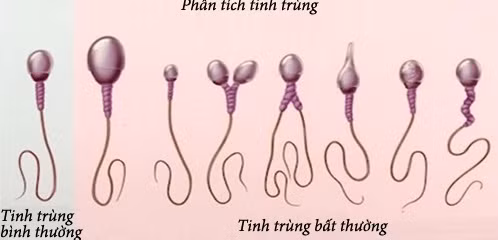 vo sinh chung benh thoi hien dai