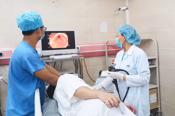 Nội soi dạ dày, những điều cần biết