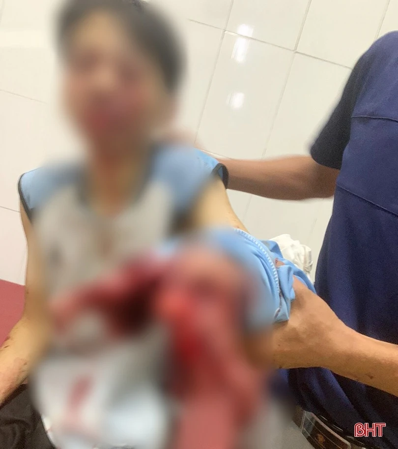 Sau tiếng nổ lớn, nam sinh ở Hà Tĩnh dập nát bàn tay