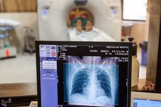 Iran sử dụng trí tuệ nhân tạo phát hiện người nhiễm Covid-19