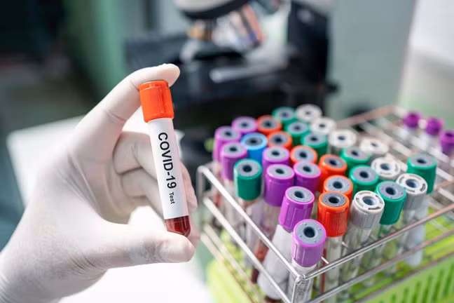 nga điều chế thành công 3 loại thuốc có thể giúp điều trị covid-19 hình 1 Nga điều chế thành công 3 loại thuốc có thể giúp điều trị Covid-19