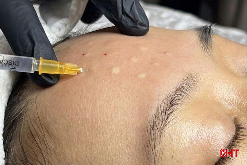 Tiêm meso phục hồi da tại các cơ sở spa không phép. bqbht_br_tmv2.jpg