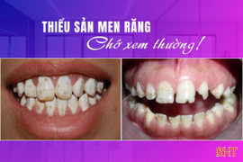 Thiểu sản men răng: Chớ xem thường!