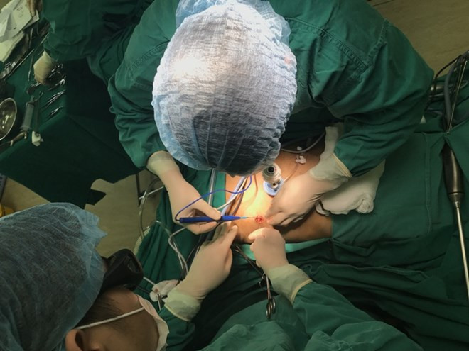 Bệnh viện K thực hiện thành công phẫu thuật nội soi 3D - 1 lỗ Trocart ảnh 1 Bệnh viện K thực hiện thành công phẫu thuật nội soi 3D - 1 lỗ Trocart