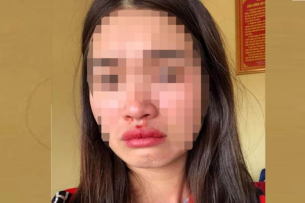 Hà Tĩnh khởi tố vợ chồng xe buýt nhái” hành hung hành khách