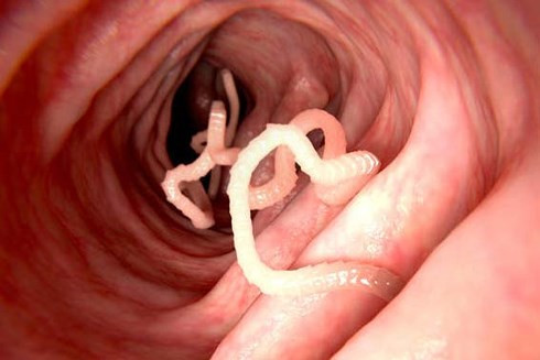 Khiếp sợ trước 19 loài động vật nguy hiểm chết người nhất thế giới