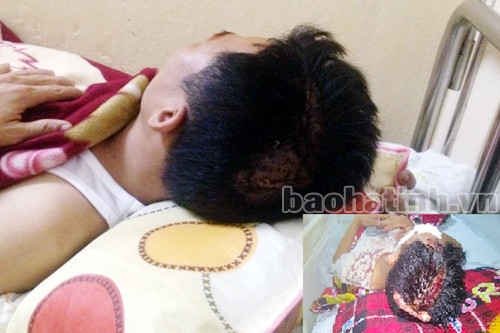 Vết thương trên đầu nạn nhân (ảnh lớn) đã không còn nặng như lúc nhập viện (ảnh nhỏ).