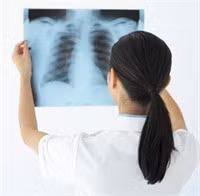 Số người mắc bệnh lao có xu hướng ngày càng gia tăng. Ảnh: xaluan.com
