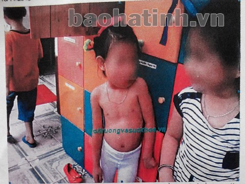 Hình ảnh các cháu đang cởi trần được "phóng viên" nhanh chóng chụp lại. Mặc dù trong ảnh cho thấy các cháu đang thay trang phục sau khi tập văn nghệ (quần tất trắng) và phía sau là tủ đựng quần áo nhưng "phóng viên" vẫn cho rằng các cô chăm sóc trẻ như vậy là không đảm bảo.