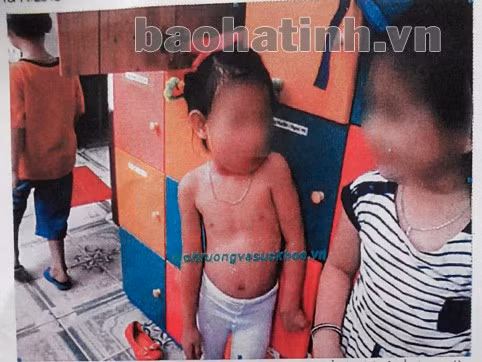 Hình ảnh các cháu đang cởi trần được "phóng viên" nhanh chóng chụp lại. Mặc dù trong ảnh cho thấy các cháu đang thay trang phục sau khi tập văn nghệ (quần tất trắng) và phía sau là tủ đựng quần áo nhưng "phóng viên" vẫn cho rằng các cô chăm sóc trẻ như vậy là không đảm bảo.