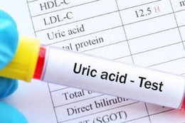 Ai có nguy cơ bị tăng acid uric máu?