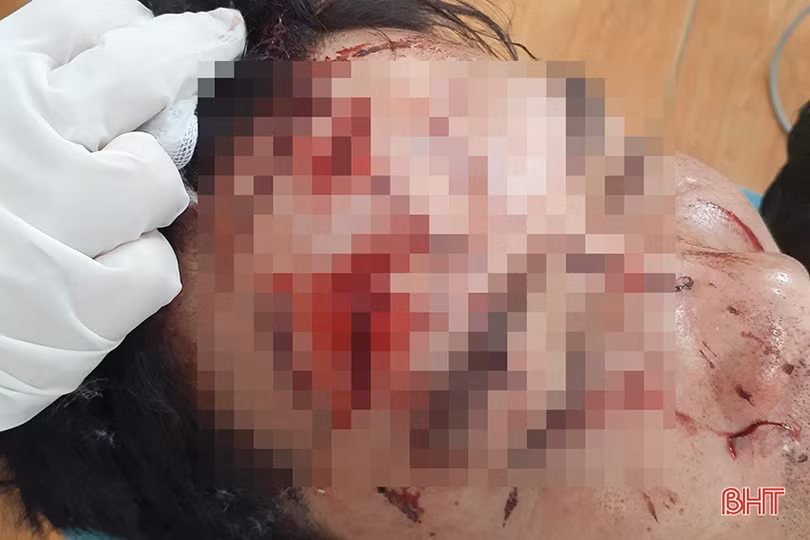 Đối tượng cộm cán ở Hương Khê vừa ra tù lại đánh người nhập viện