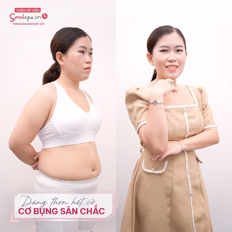 Giảm béo ở đâu tốt nhất, review giảm béo tại SeoulSpa.Vn