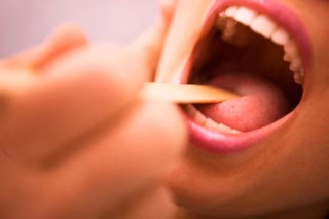 viem amidan khi nao can cat