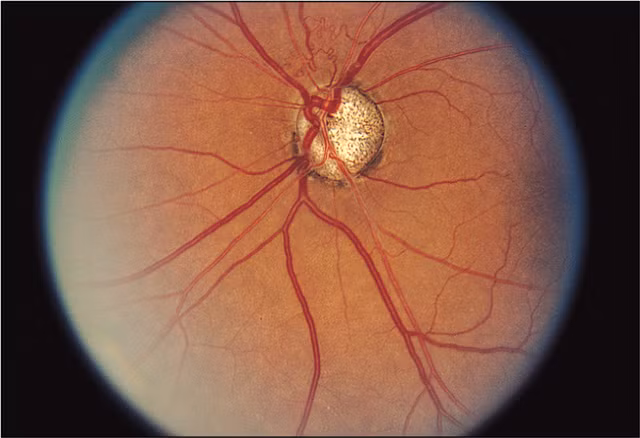 su that ve methanol chat long giong ruou nhung vo cung nguy hiem