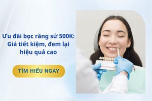 Ưu đãi bọc răng sứ 500K: Giá tiết kiệm, đem lại hiệu quả cao