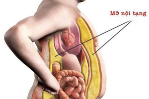 Mỡ nội tạng có hại thế nào với sức khỏe?