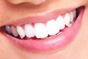 Những thói quen thường gặp có thể gây hại cho răng