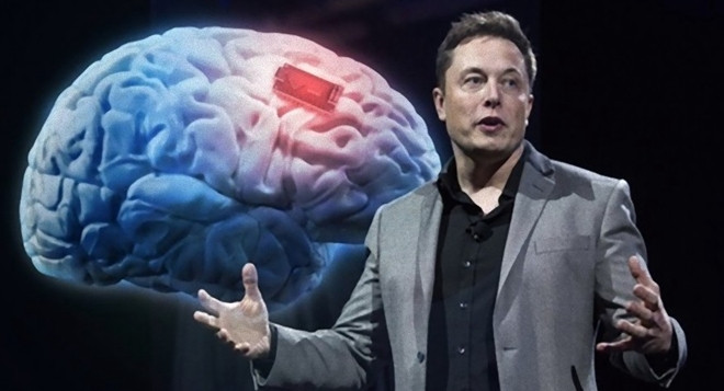 Dự án Neuralink của tỉ phú Elon Musk tham vọng cấy chip điện tử vào não người. Dự án đọc não người: Tưởng đùa mà thật