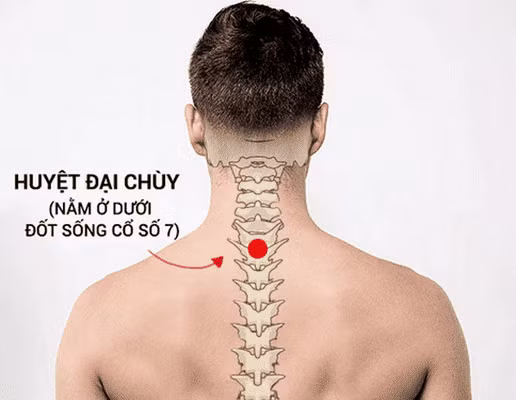 Day huyệt đại chùy trị cảm cúm, đau cổ vai gáy