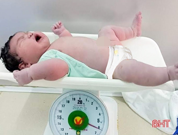 Em bé chào đời ở Hà Tĩnh nặng 6,2kg