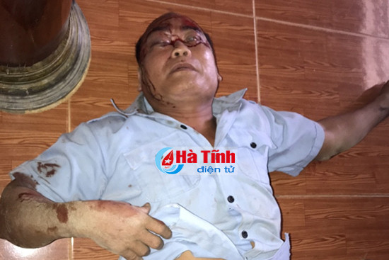 trieu tap 3 doi tuong xong vao nha danh trong thuong nguoi vo toi