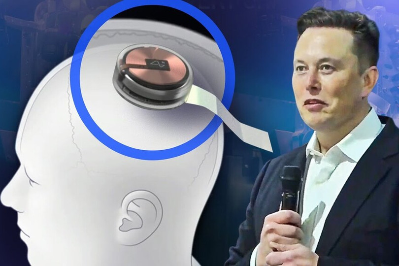 Neuralink có thể cấy chip lên não người trong năm nay