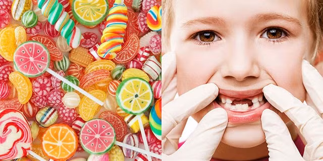 5 thói quen ăn uống sai cách có thể phá hủy răng của trẻ