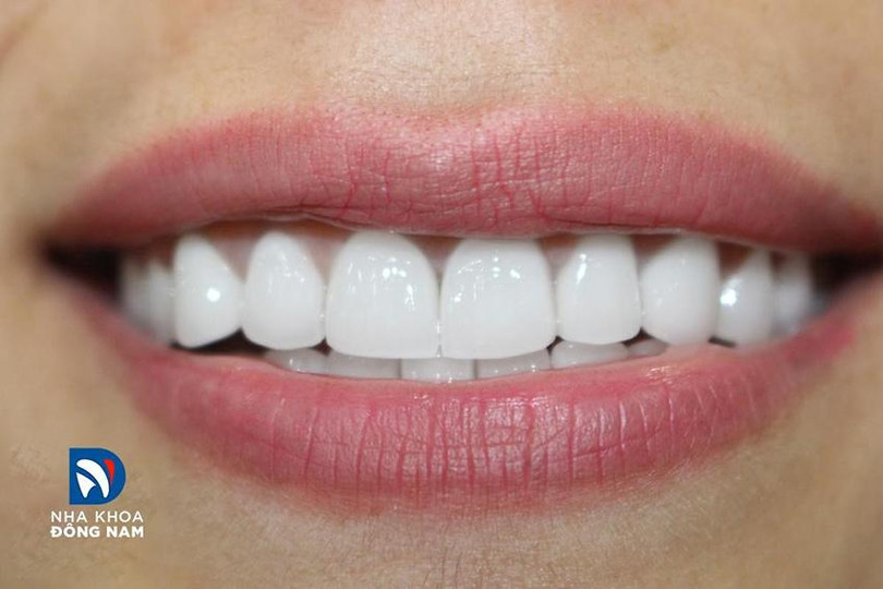 Mỗi nụ cười là độc nhất thuộc về riêng bạn Chinh phục 3.jpg
