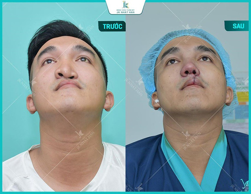 Lê Viết Trí 2.jpg