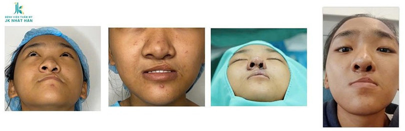 Lê Viết Trí 5.jpg