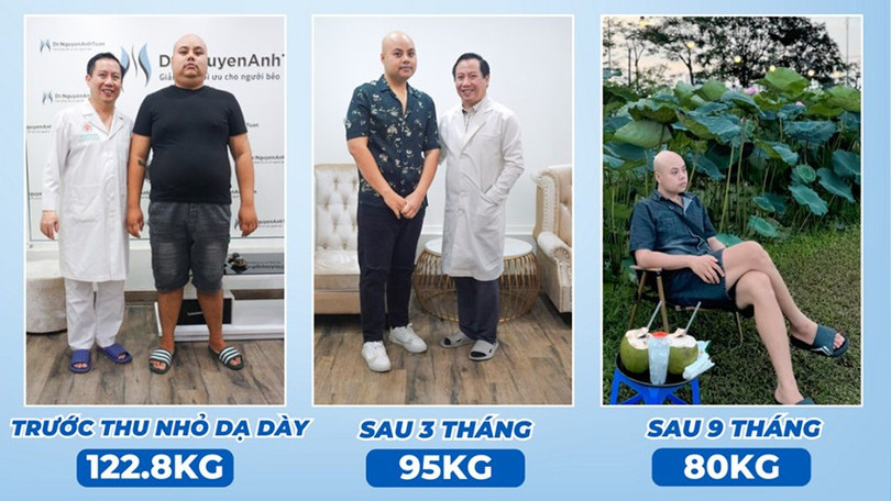 Thay đổi của bệnh nhân T.D sau 9 tháng thu nhỏ dạ dày thu-nho-3.jpg