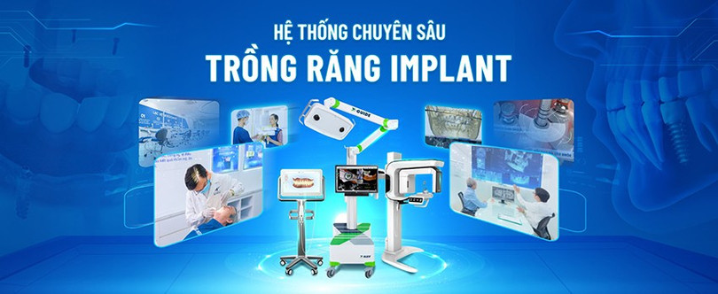 Nha khoa Lạc Việt Intech luôn dẫn đầu trong việc ứng dụng công nghệ hiện đại vào trồng răng, chỉnh nha lac-viet-1.jpg