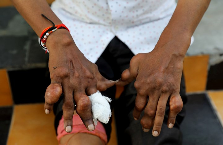 Cận cảnh công việc của các công nhân ngụp lặn trong ống thải ở Ấn Độ