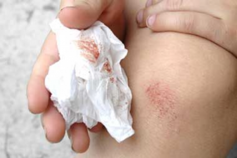 8 công dụng kỳ lạ của hạt tiêu