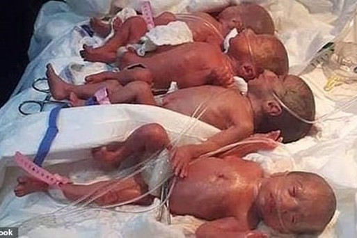 Ca sinh 9 hiếm có trên thế giới tại một bệnh viện ở Maroc