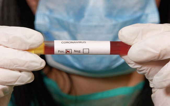 Chiều 5/5, thêm 26 ca mắc Covid-19, có 18 ca ghi nhận trong nước ảnh 6 Chiều 5/5, thêm 26 ca mắc Covid-19, có 18 ca ghi nhận trong nước