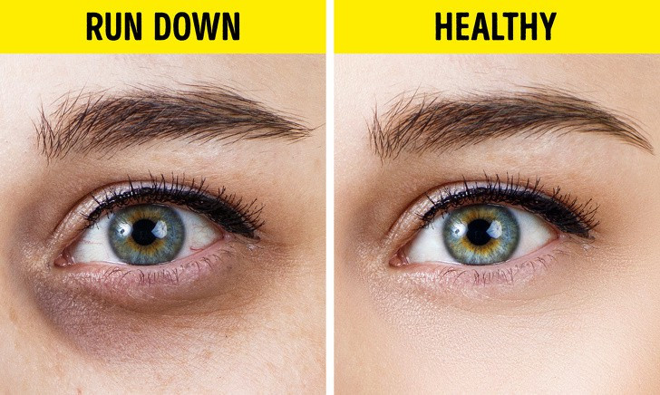 10 thay đổi trong cơ thể tiết lộ tình trạng sức khoẻ của bạn hình 10 10 thay đổi trong cơ thể tiết lộ tình trạng sức khoẻ của bạn