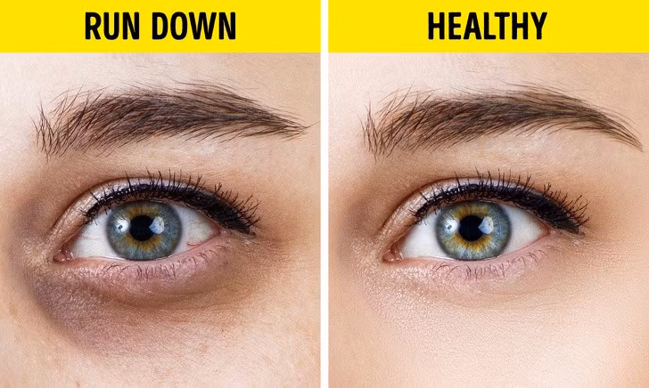 10 thay đổi trong cơ thể tiết lộ tình trạng sức khoẻ của bạn