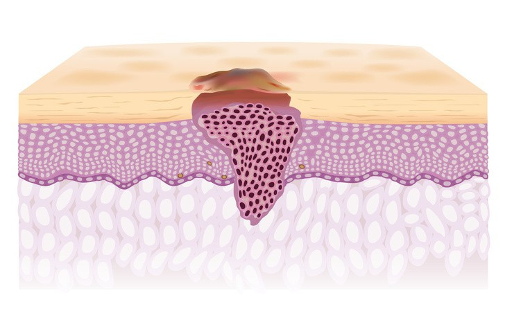 10 thay đổi trong cơ thể tiết lộ tình trạng sức khoẻ của bạn hình 6 10 thay đổi trong cơ thể tiết lộ tình trạng sức khoẻ của bạn