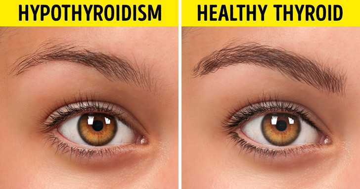 10 thay đổi trong cơ thể tiết lộ tình trạng sức khoẻ của bạn hình 5 10 thay đổi trong cơ thể tiết lộ tình trạng sức khoẻ của bạn