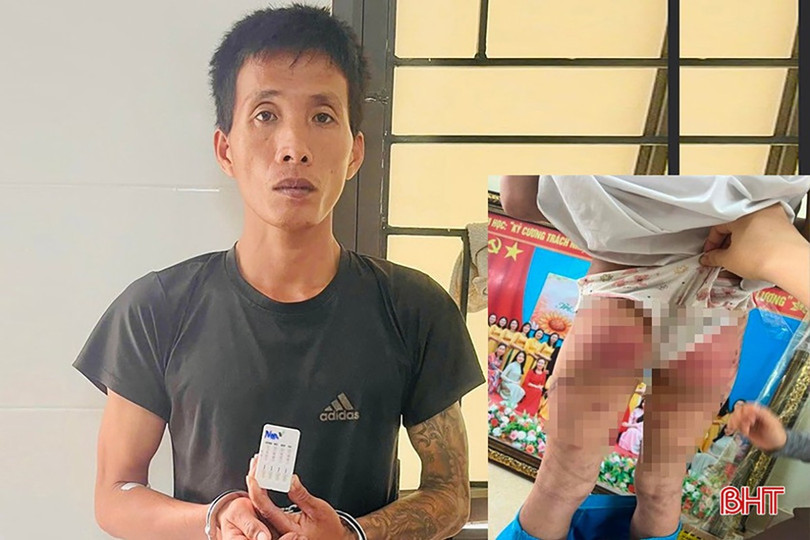 Nguyễn Văn Nam (31 tuổi, trú thôn Phú Hòa, xã Cổ Đạm, Hà Tĩnh) - người cha dượng bạo hành con riêng đã bị Cơ quan CSĐT Công an tỉnh Hà Tĩnh khởi tố, bắt tạm giam để điều tra về hành vi “cố ý gây thương tích”. 3.jpg